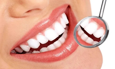 Teeth cleaning and polishing including dental consultation in Durban - R 399.00